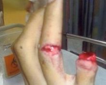 احتسب ضربة جزاء فعاقبوه ببتر أصبعه !!!