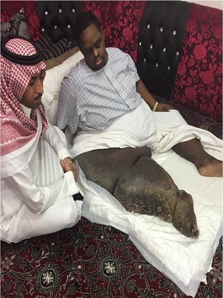 رئيس الديوان الملكي يُوجهّ بعلاج المصاب بـ