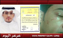 جريدة الجزيرة تواصل الاستهتار بمنقذ المسنة والفتيات الاربع وقناة فضائية تطلب استضافتة (متابعة مستمرة)