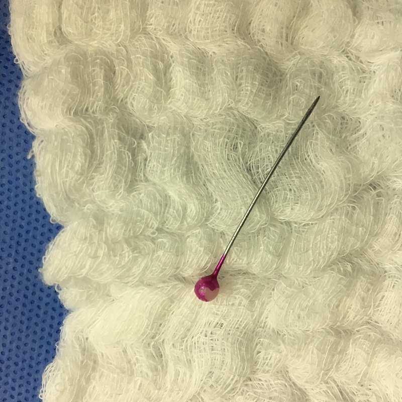 إنقاذ حياة طفلة ابتلعت (إبرة معدنية) بمستشفى عرعر المركزي