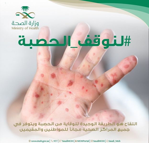 الصحة تطلق الحملة الوطنية للتطعيم ضد الحصبة