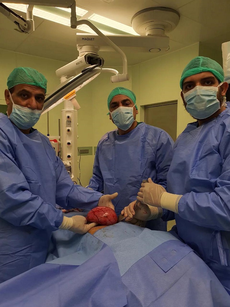 فريق طبي بصحة الشمالية ينجح باستخراج جسم ضخم من معدة مريض