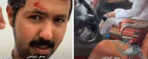 شاهد .. برد مصحوب برياح قوية يصيب الأشخاص ويهشم السيارات بحفر الباطن!