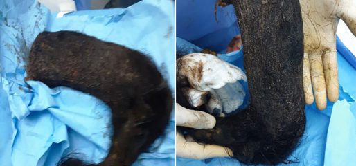 إخراج 2 كيلو من الشعر داخل بطن فتاة بـ”الطائف” !!