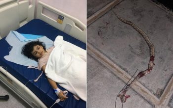 لدغة أفعى سامة تنقل طفلة بنجران للعناية المركزة .. ووالدها يروي التفاصيل