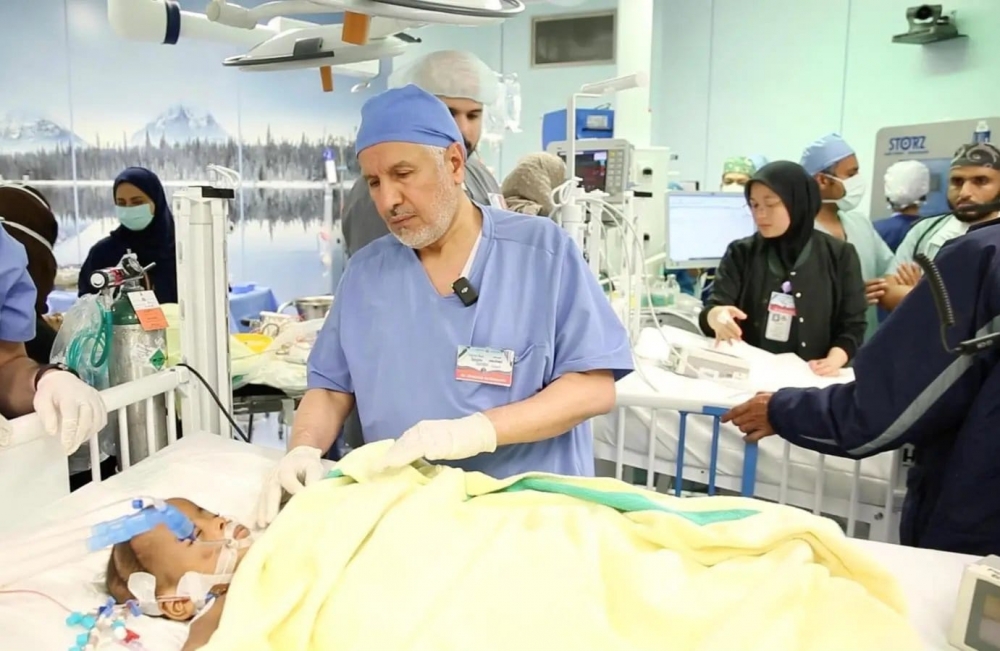 نجاح فصل التوأم السيامي النيجيري